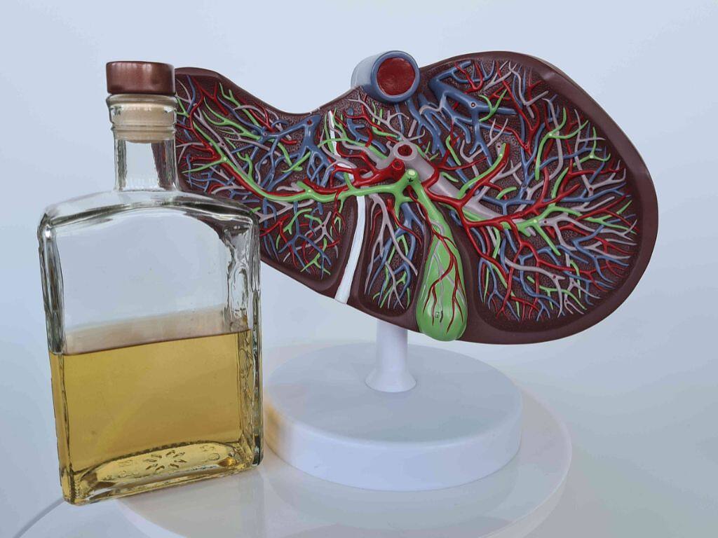 Model of a liver next to a bottle of alcohol, symbolizing the effects of alcohol on liver health|Two shirtless men standing back to back; one holds a water bottle, and the other holds a beer bottle, representing healthy living versus alcohol consumption.