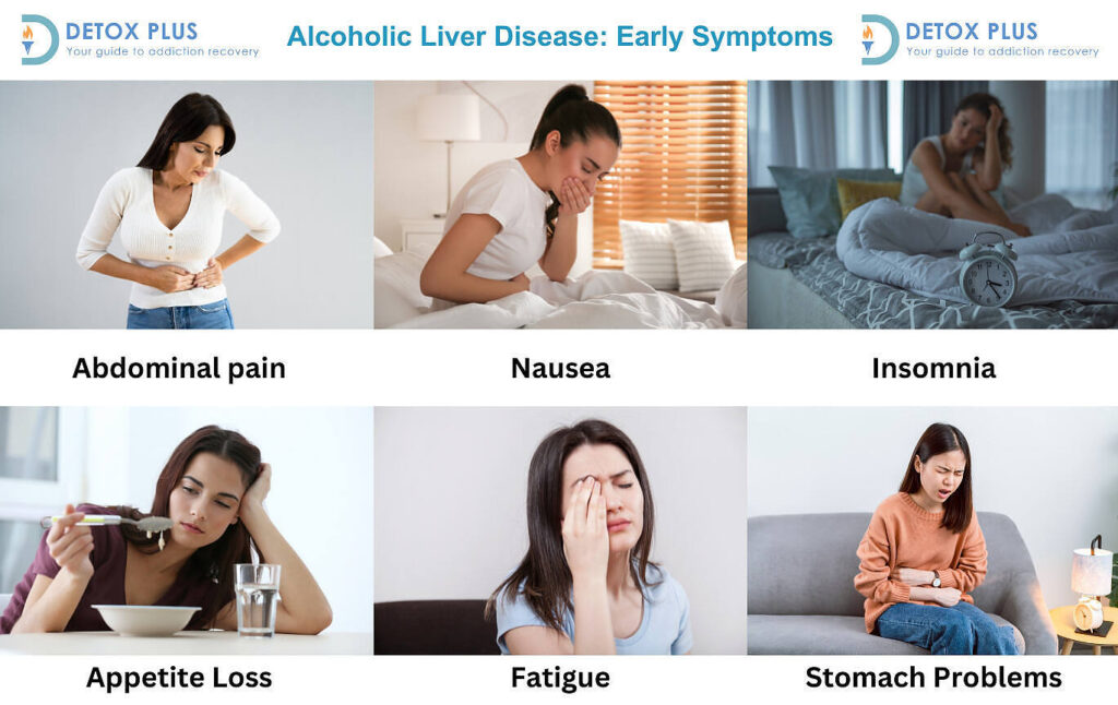 Infographic showing six early symptoms of alcoholic liver disease: abdominal pain, nausea, insomnia, appetite loss, fatigue, and stomach problems, with corresponding images of people experiencing each symptom|Infographic displaying six latter symptoms of alcoholic liver disease: jaundice, itching, swollen extremities, weight loss, bruising and bleeding, and brain fog, with corresponding images illustrating each symptom